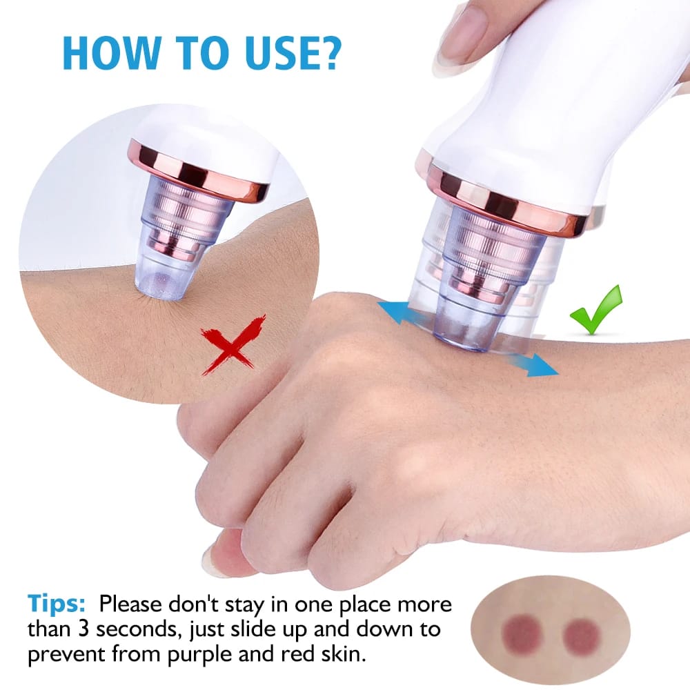 5 in 1 Blackhead remover | Derma Suction | Rechargeable | Free Gift Card 🎁